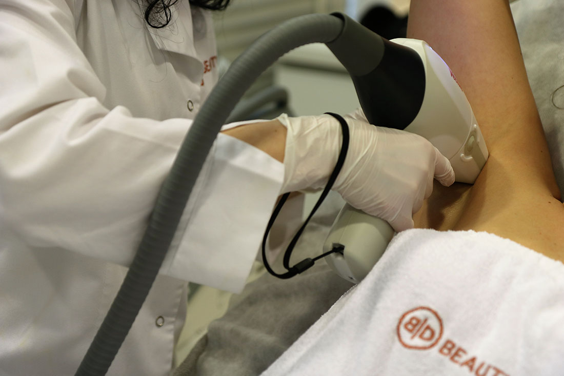 Depilacja laserowa w klinice urody Beauty Duty