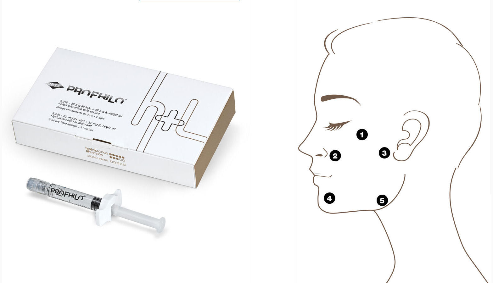 Profhilo® - preparat o najwyższym stężeniu kwasu hialuronowego w jednej cząsteczce